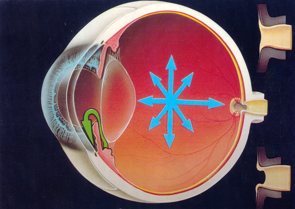 La presión interna (flechas azules) se transmite al punto más debil, el nervio óptico