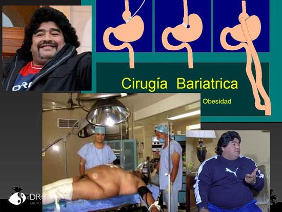 bariatrica_2