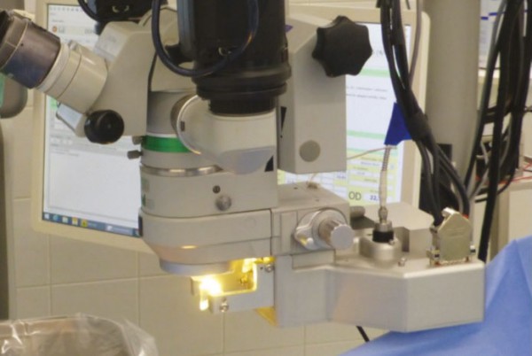 El dispositivo CapsuLaser™ se monta en el microscopio.